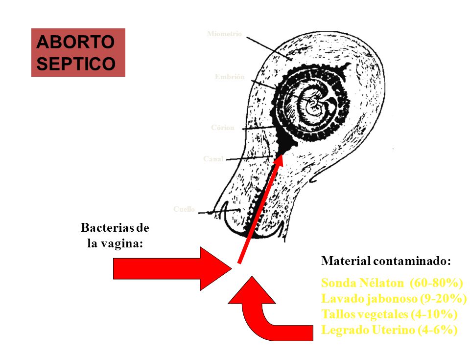 Jabonoso espéculo Jabonoso espéculo